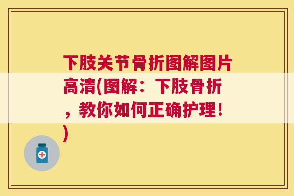 下肢关节骨折图解图片高清(图解：下肢骨折，教你如何正确护理！)