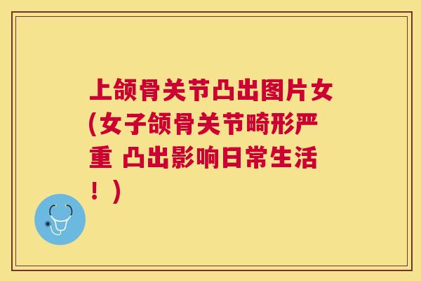 上颌骨关节凸出图片女(女子颌骨关节畸形严重 凸出影响日常生活！)
