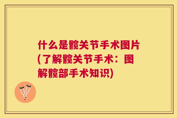 什么是髋关节手术图片(了解髋关节手术：图解髋部手术知识)