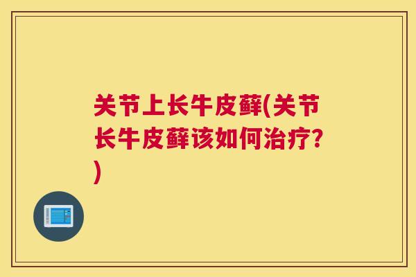 关节上长牛皮藓(关节长牛皮藓该如何治疗?)