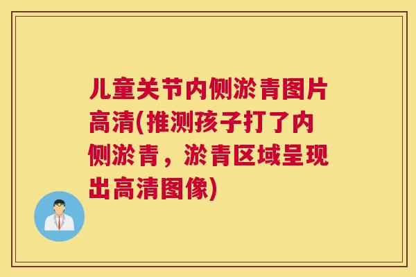 儿童关节内侧淤青图片高清(推测孩子打了内侧淤青,淤青区域呈现出高清图像) 儿童关节内侧淤青图片高清(推测孩子打了内侧淤青,淤青区域呈现出高清图像)