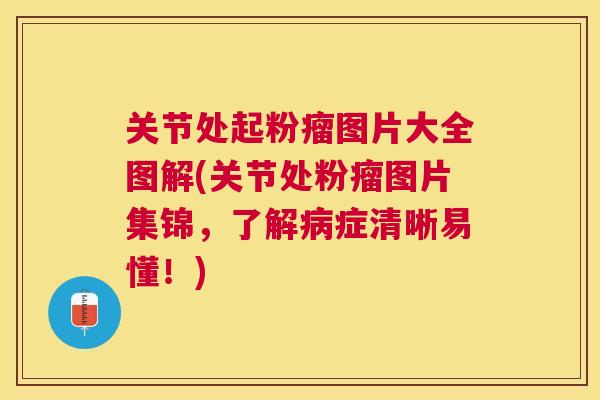 关节处起粉瘤图片大全图解(关节处粉瘤图片集锦，了解病症清晰易懂！)