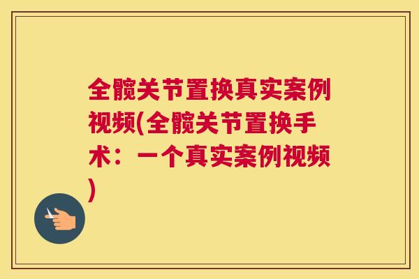 全髋关节置换真实案例视频(全髋关节置换手术:一个真实案例视频)