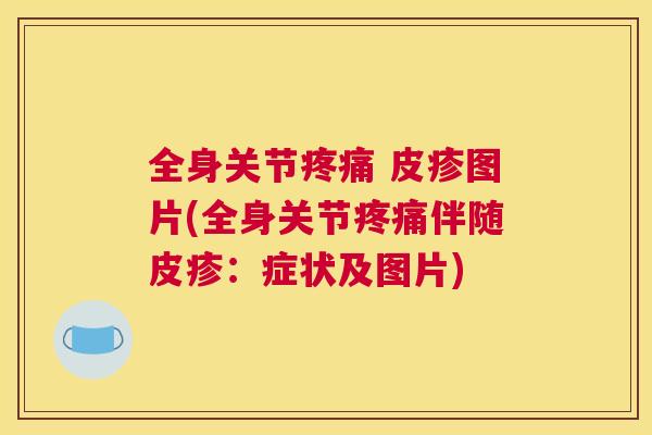 全身关节 皮疹图片(全身关节伴随皮疹：症状及图片)