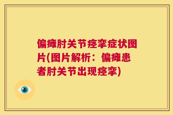 偏瘫肘关节痉挛症状图片(图片解析：偏瘫患者肘关节出现痉挛)