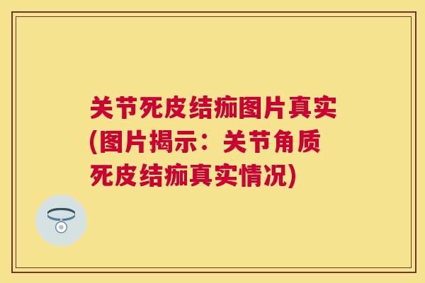 关节死皮结痂图片真实(图片揭示:关节角质死皮结痂真实情况) 关节死皮结痂图片真实(图片揭示:关节角质死皮结痂真实情况)