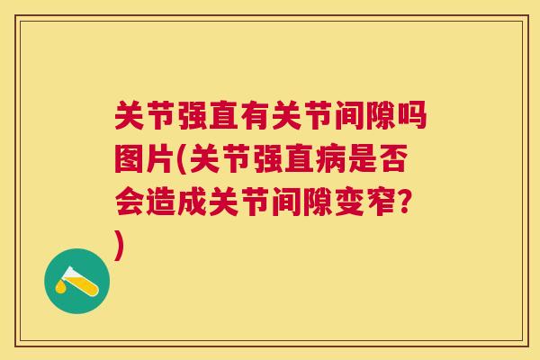 关节强直有关节间隙吗图片(关节强直是否会造成关节间隙变窄?) 关节强直有关节间隙吗图片(关节强直是否会造成关节间隙变窄?)