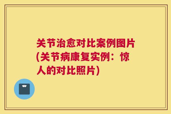 关节治愈对比案例图片(关节病康复实例:惊人的对比照片)