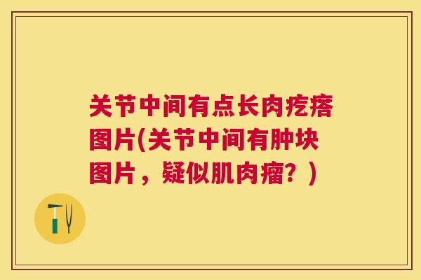 关节中间有点长肉疙瘩图片(关节中间有肿块图片,疑似肌肉瘤?)
