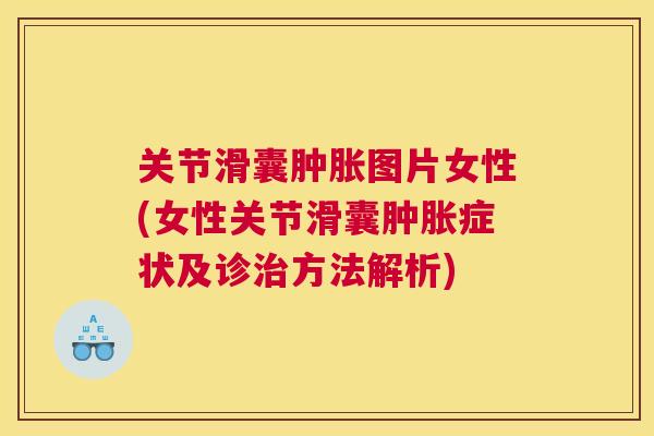 关节滑囊图片女性(女性关节滑囊症状及诊方法解析) 关节滑囊图片女性(女性关节滑囊症状及诊方法解析)