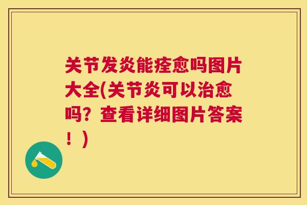 关节发炎能痊愈吗图片大全(关节炎可以治愈吗?查看详细图片答案!)