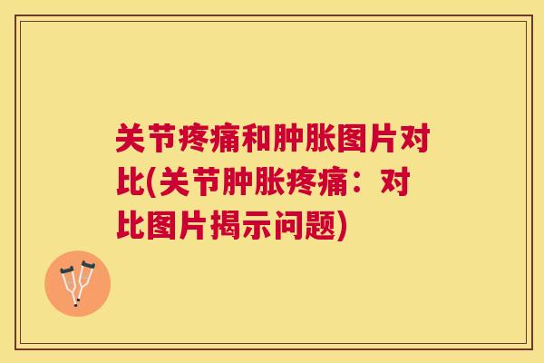 关节和图片对比(关节:对比图片揭示问题) 关节和图片对比(关节:对比图片揭示问题)