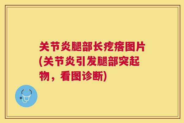 关节炎腿部长疙瘩图片(关节炎引发腿部突起物，看图诊断)