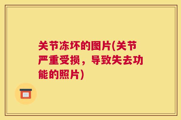 关节冻坏的图片(关节严重受损，导致失去功能的照片)