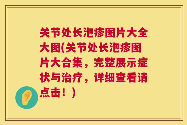 关节处长泡疹图片大全大图(关节处长泡疹图片大合集,完整展示症状与,详细查看请点击!) 关节处长泡疹图片大全大图(关节处长泡疹图片大合集,完整展示症状与,详细查看请点击!)