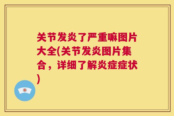 关节发炎了严重嘛图片大全(关节发炎图片集合,详细了解炎症症状)