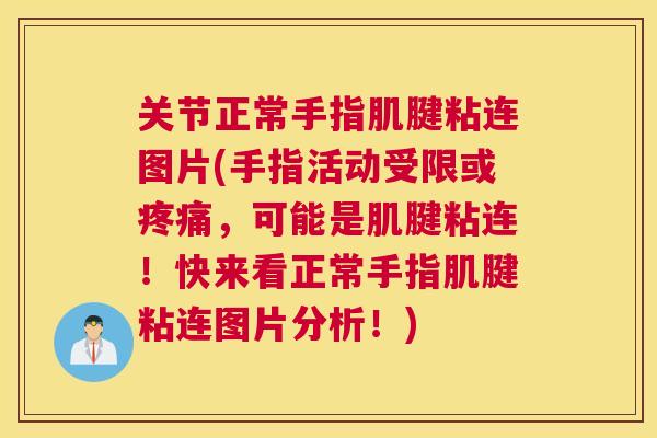 关节正常手指肌腱粘连图片(手指活动受限或疼痛,可能是肌腱粘连!快来看正常手指肌腱粘连图片分析!)