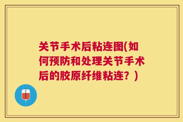 关节手术后粘连图(如何和处理关节手术后的胶原纤维粘连？)
