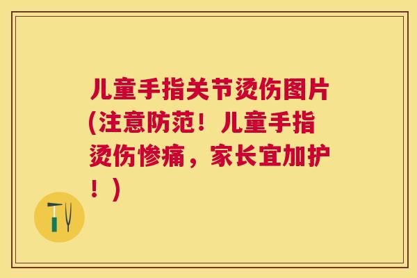 儿童手指关节烫伤图片(注意防范!儿童手指烫伤惨痛,家长宜加护!) 儿童手指关节烫伤图片(注意防范!儿童手指烫伤惨痛,家长宜加护!)
