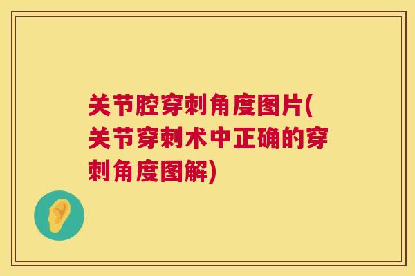 关节腔穿刺角度图片(关节穿刺术中正确的穿刺角度图解)
