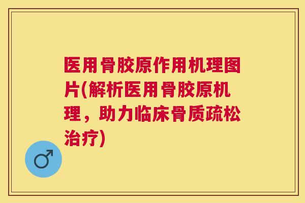 医用骨胶原作用机理图片(解析医用骨胶原机理,助力临床) 医用骨胶原作用机理图片(解析医用骨胶原机理,助力临床)