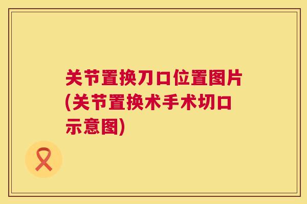 关节置换刀口位置图片(关节置换术手术切口示意图)