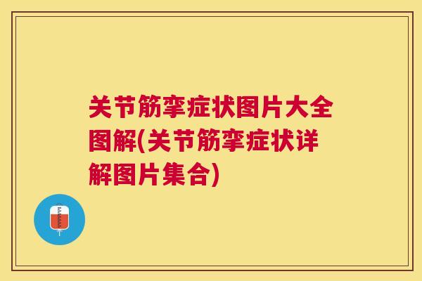 关节筋挛症状图片大全图解(关节筋挛症状详解图片集合)