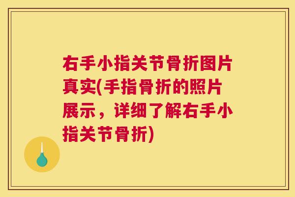 右手小指关节骨折图片真实(手指骨折的照片展示,详细了解右手小指关节骨折)