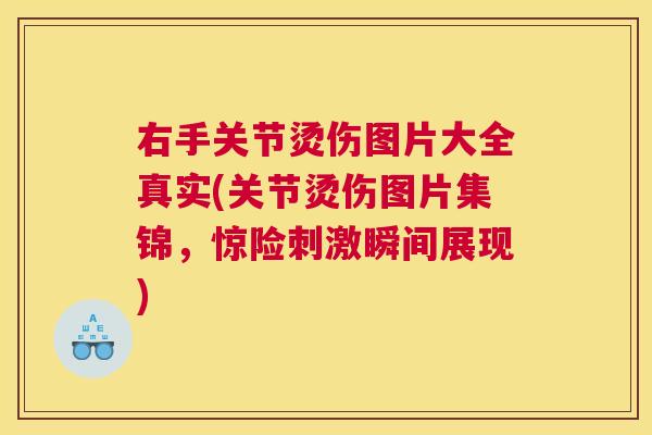 右手关节烫伤图片大全真实(关节烫伤图片集锦,惊险刺激瞬间展现)