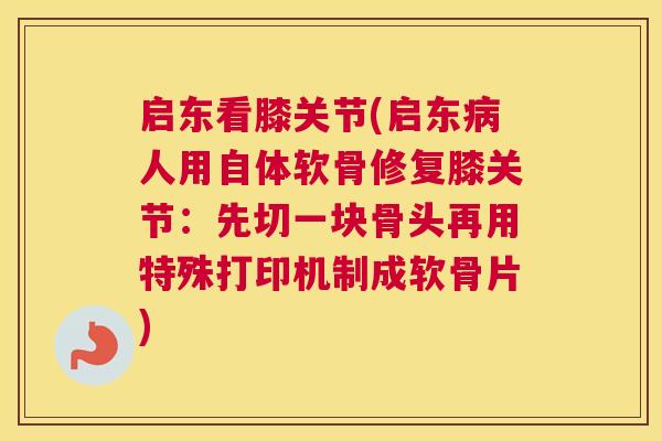 启东看膝关节(启东病人用自体软骨修复膝关节:先切一块骨头再用特殊打印机制成软骨片)