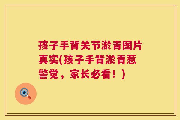 孩子手背关节淤青图片真实(孩子手背淤青惹警觉,家长必看!)
