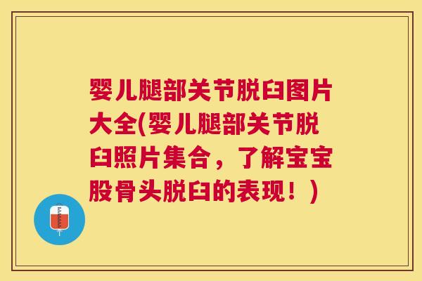 婴儿腿部关节脱臼图片大全(婴儿腿部关节脱臼照片集合,了解宝宝股骨头脱臼的表现!)