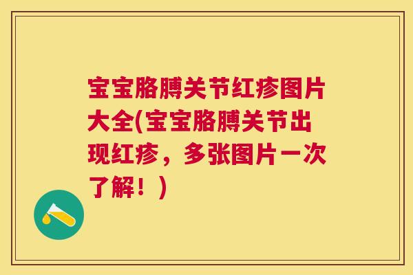 宝宝胳膊关节红疹图片大全(宝宝胳膊关节出现红疹，多张图片一次了解！)