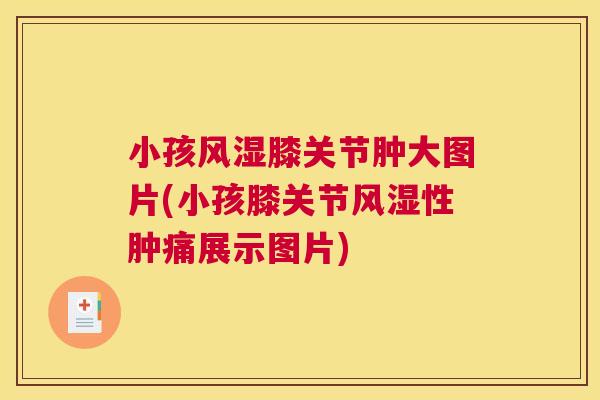 小孩风湿膝关节肿大图片(小孩膝关节风湿性肿痛展示图片)