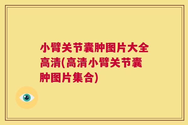 小臂关节囊肿图片大全高清(高清小臂关节囊肿图片集合)