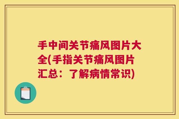 手中间关节痛风图片大全(手指关节痛风图片汇总:了解病情常识)
