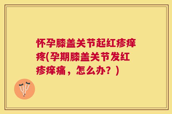 怀孕膝盖关节起红疹痒疼(孕期膝盖关节发红疹痒痛,怎么办?) 怀孕膝盖关节起红疹痒疼(孕期膝盖关节发红疹痒痛,怎么办?)