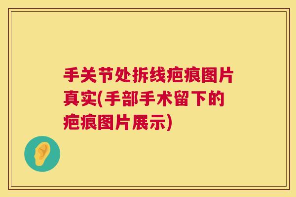 手关节处拆线疤痕图片真实(手部手术留下的疤痕图片展示)