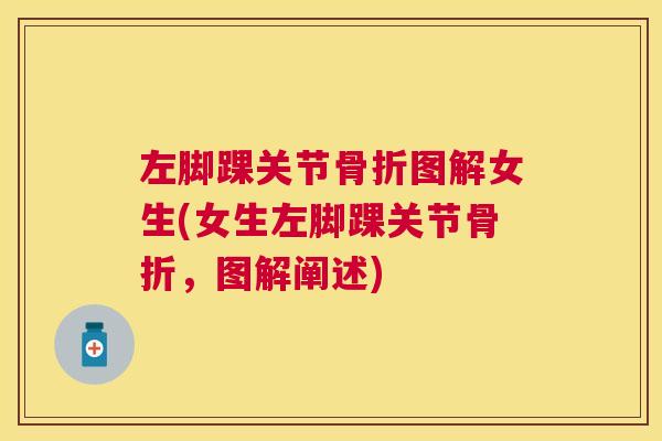 左脚踝关节骨折图解女生(女生左脚踝关节骨折,图解阐述)