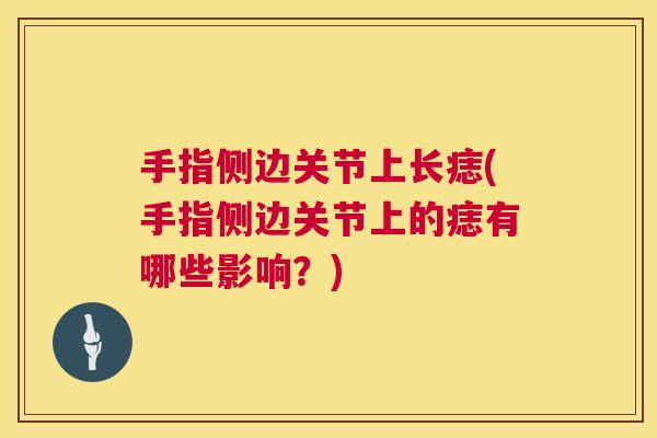 手指侧边关节上长痣(手指侧边关节上的痣有哪些影响?)