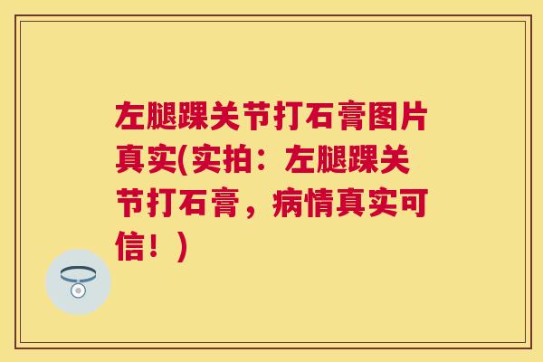 左腿踝关节打石膏图片真实(实拍:左腿踝关节打石膏,病情真实可信!)