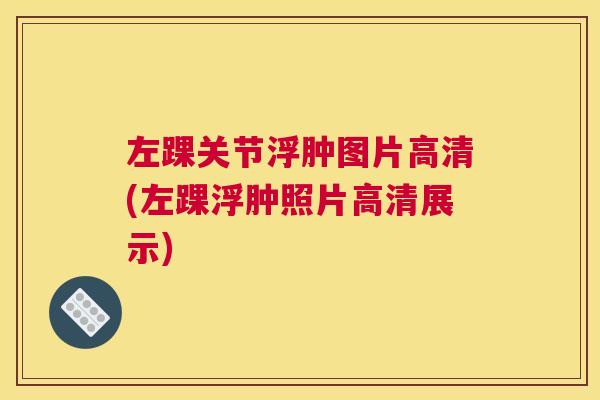 左踝关节浮肿图片高清(左踝浮肿照片高清展示)