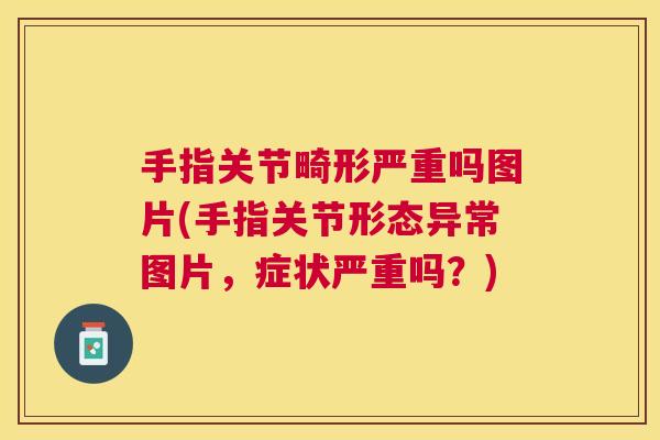 手指关节畸形严重吗图片(手指关节形态异常图片,症状严重吗?)