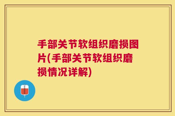 手部关节软组织磨损图片(手部关节软组织磨损情况详解) 手部关节软组织磨损图片(手部关节软组织磨损情况详解)