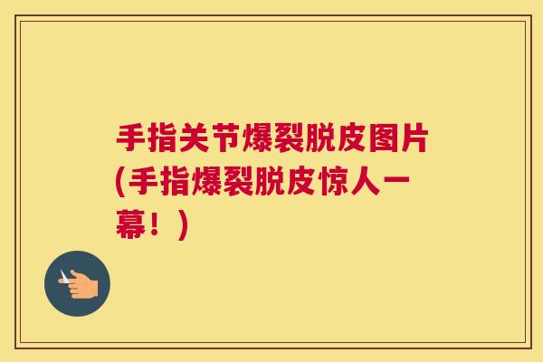 手指关节爆裂脱皮图片(手指爆裂脱皮惊人一幕!)