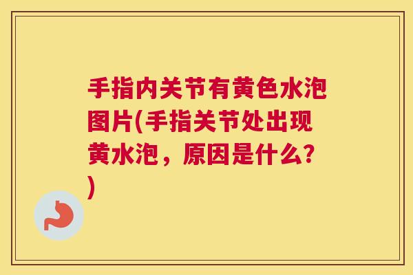 手指内关节有黄色水泡图片(手指关节处出现黄水泡,原因是什么?) 手指内关节有黄色水泡图片(手指关节处出现黄水泡,原因是什么?)
