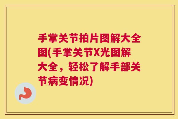 手掌关节拍片图解大全图(手掌关节X光图解大全,轻松了解手部关节变情况) 手掌关节拍片图解大全图(手掌关节X光图解大全,轻松了解手部关节变情况)