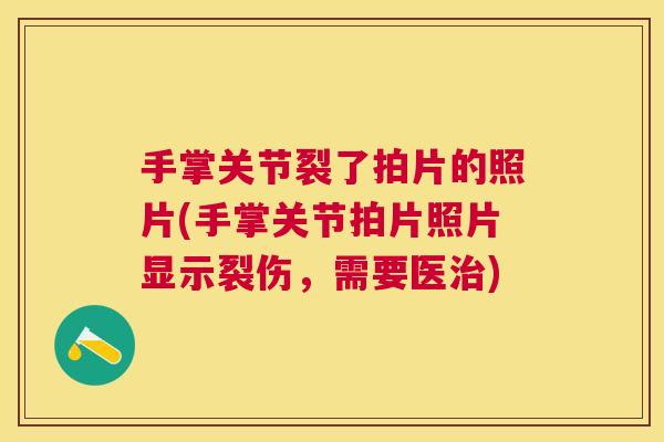 手掌关节裂了拍片的照片(手掌关节拍片照片显示裂伤,需要医治)
