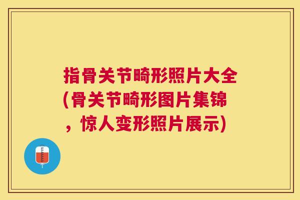 指骨关节畸形照片大全(骨关节畸形图片集锦，惊人变形照片展示)