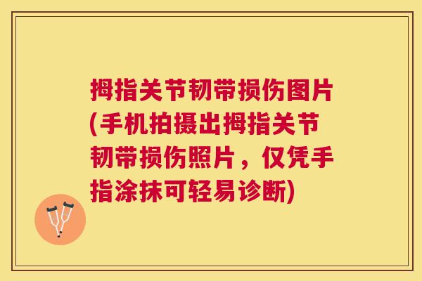 拇指关节韧带损伤图片(手机拍摄出拇指关节韧带损伤照片,仅凭手指涂抹可轻易诊断) 拇指关节韧带损伤图片(手机拍摄出拇指关节韧带损伤照片,仅凭手指涂抹可轻易诊断)